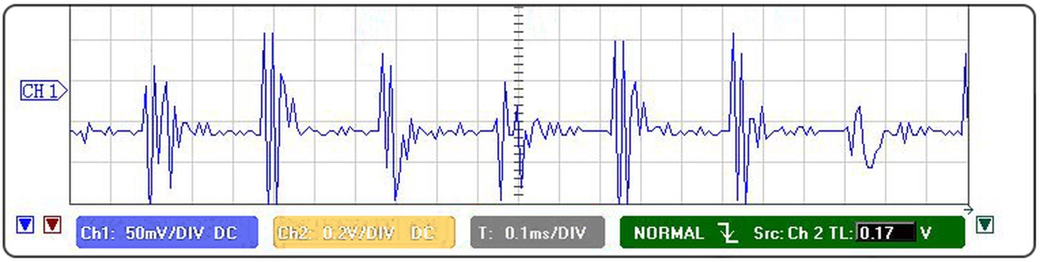 Dr. Kleanthous Kosmetik GmbH – Schönheit und Anti-Aging – Die besondere SONOSTAR25 Schallmodulationseffektiv und doch so sanft