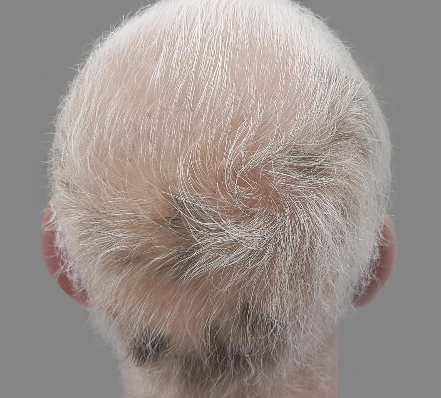 Dr. Kleanthous Kosmetik GmbH - Schönheit und Anti-Aging - Haare Konzept