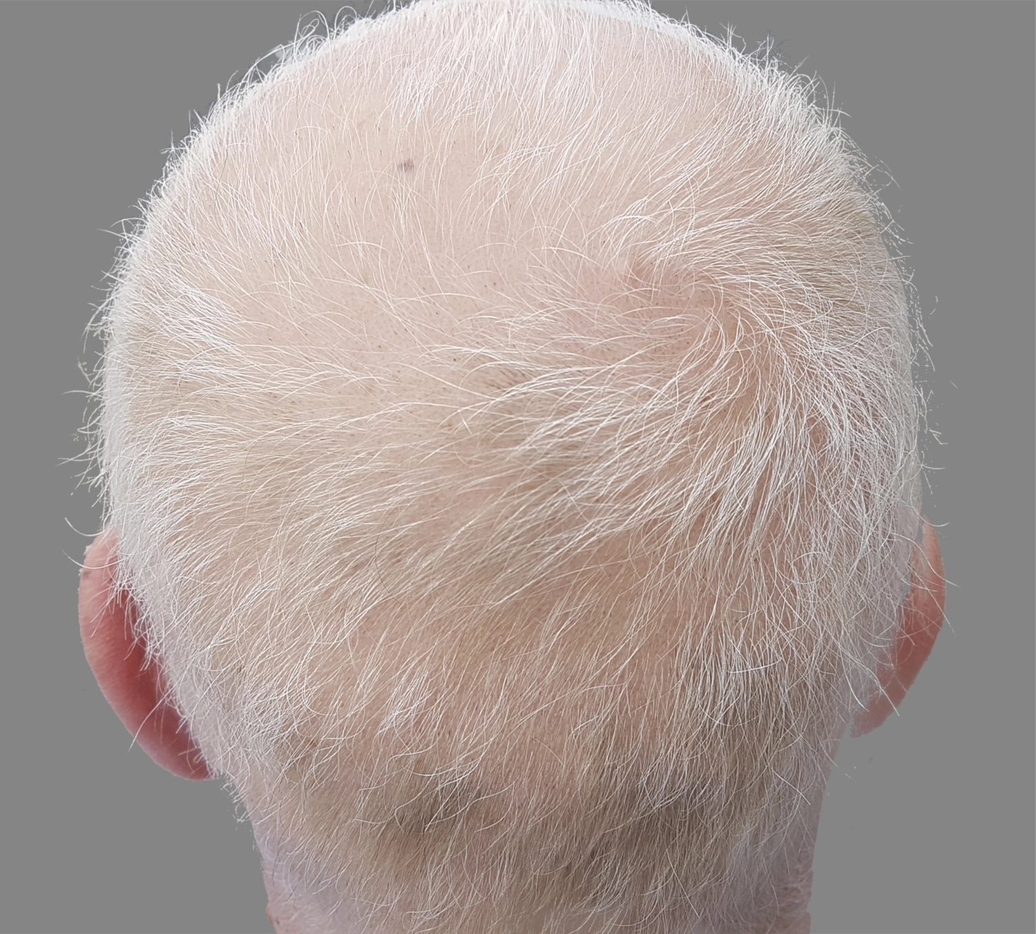 Dr. Kleanthous Kosmetik GmbH - Schönheit und Anti-Aging - Haare Konzept