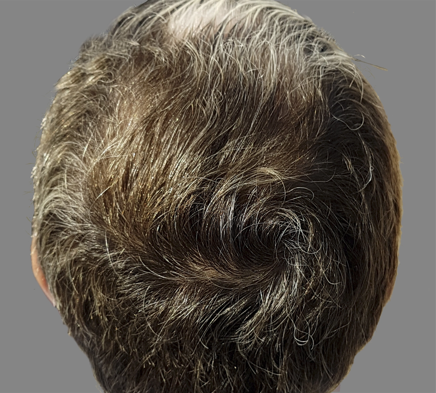 Dr. Kleanthous Kosmetik GmbH - Schönheit und Anti-Aging - Haare Konzept