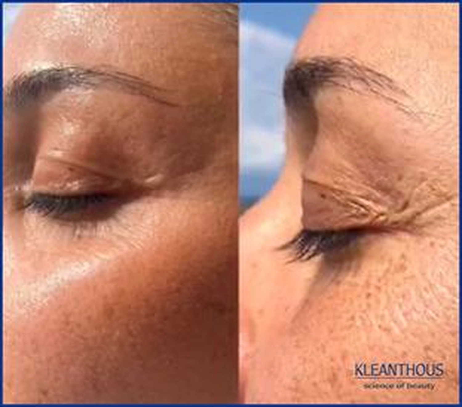 Dr. Kleanthous Kosmetik GmbH – Schönheit und Anti-Aging – Mimikkorrektur